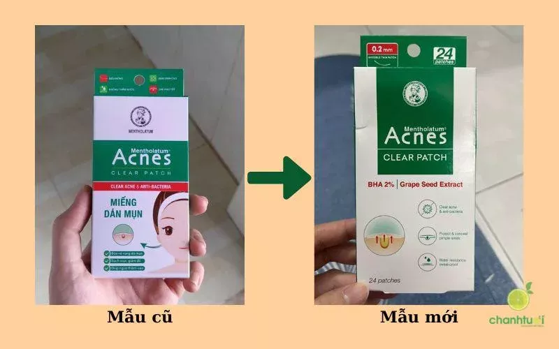 alt: Hộp miếng dán mụn Acnes