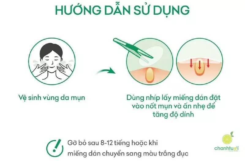 alt: Hướng dẫn sử dụng miếng dán mụn Acnes