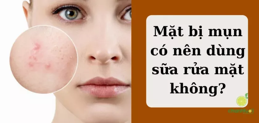 alt text: Da mụn và sữa rửa mặt