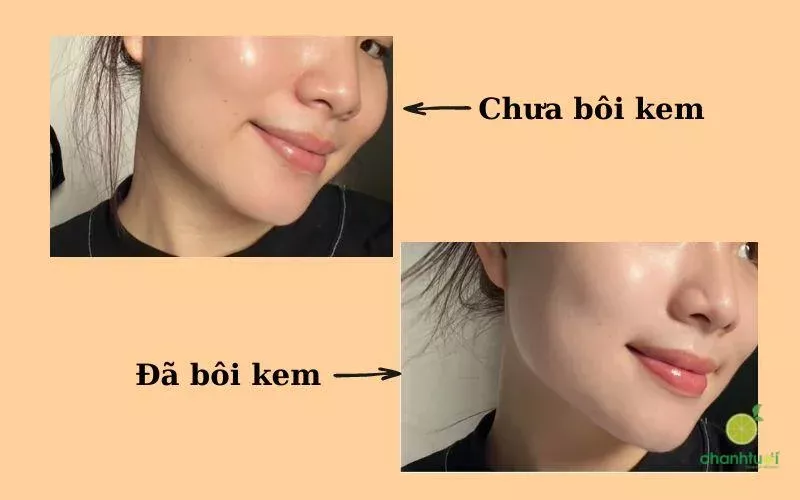 alt text: kem forencos trắng hiệu quả nâng tone da