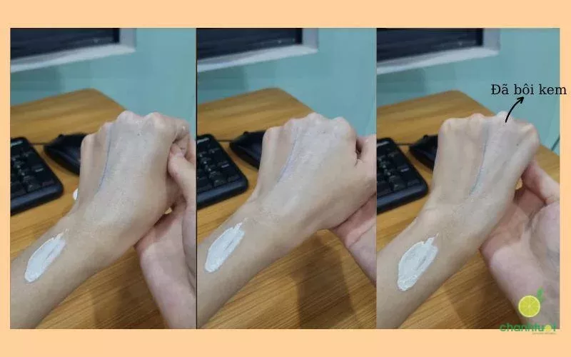 alt text: kem forencos trắng test trên da tay