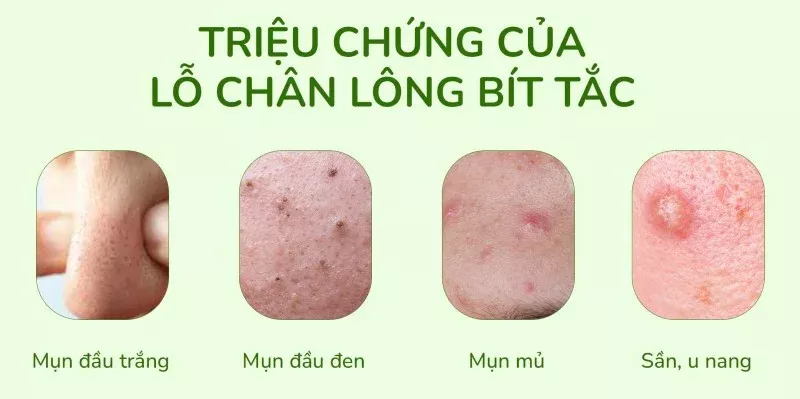 cách làm sạch lỗ chân lông 1