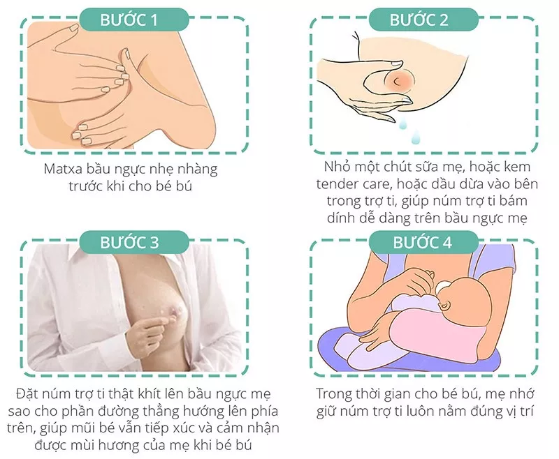 Cách sử dụng núm trợ ti