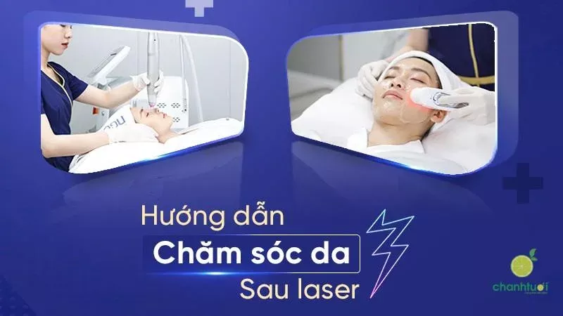 Chăm sóc da sau điều trị Laser