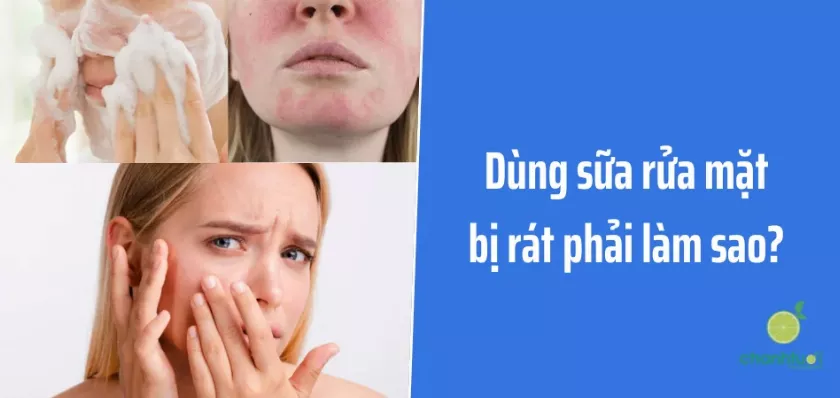 Da bị rát sau khi rửa mặt