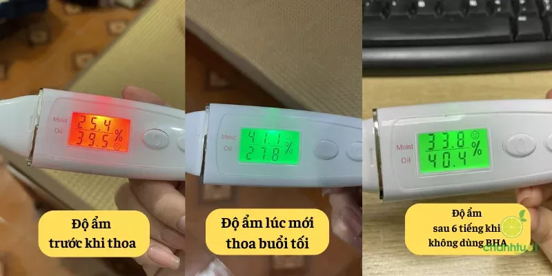 Da dầu mụn bình thường thì cấp ẩm khá tốt