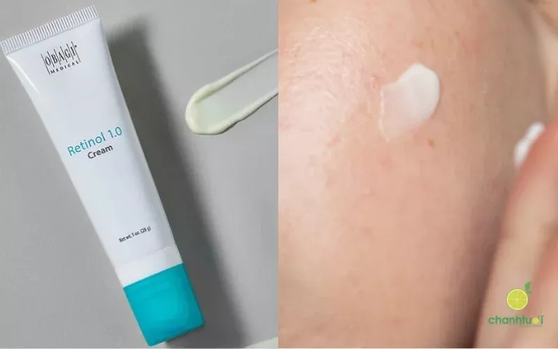 Da dầu nên dùng kem dưỡng nào kết hợp Retinol