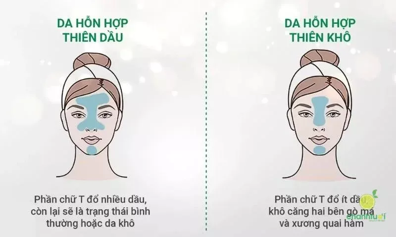 Da hỗn hợp