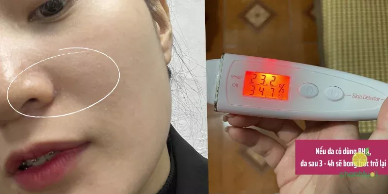 Da không đủ ẩm nếu dùng treatment