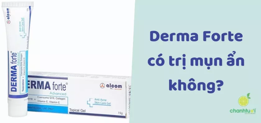 Derma Forte có trị mụn ẩn không? Bôi toàn mặt được không?