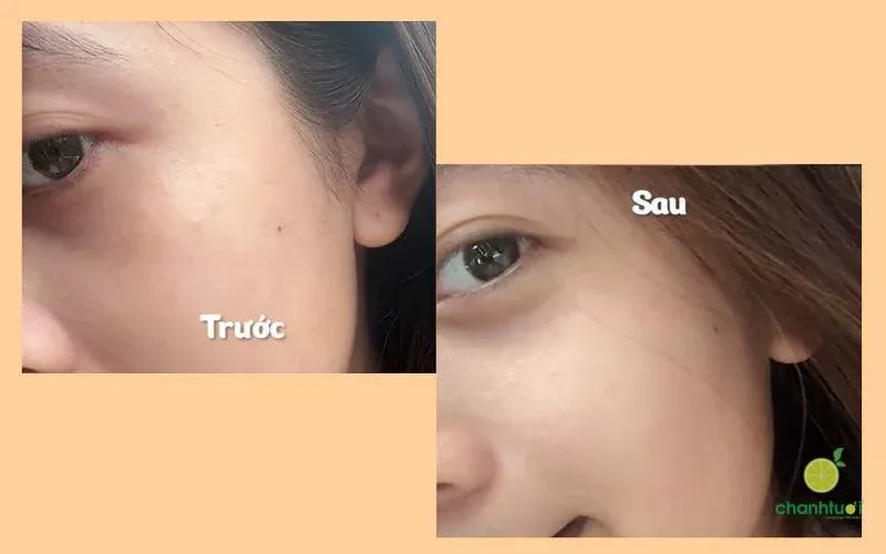 DrCeutics Niacinamide 12 NAG 5 review hiệu quả 2