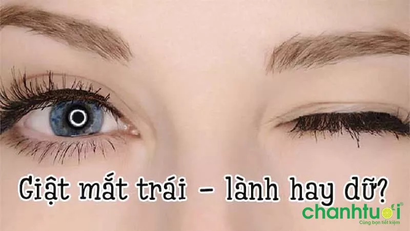 Giật mắt trái cũng có thể là điềm xấu hoặc điềm tốt 