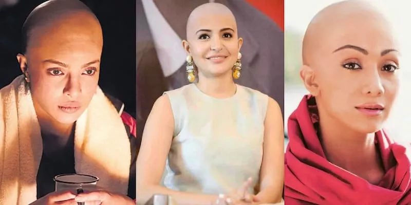 Hình ảnh một bald girl