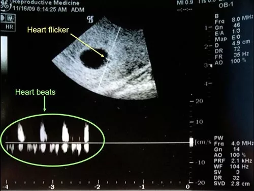 Hình thành tim thai của bé.