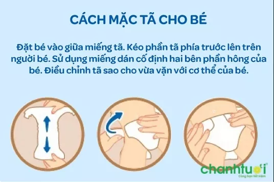 Mặc tã bỉm đúng cách giúp bé dễ chịu, thoải mái mà mẹ không lo tràn bỉm