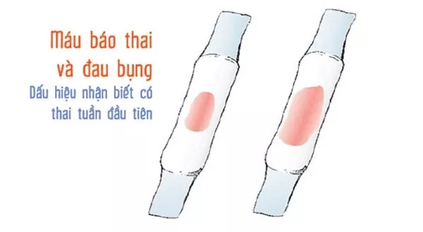 Máu báo khi mang thai