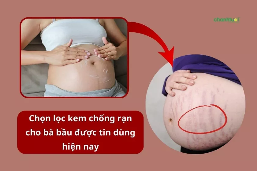 Mẹ bầu thoa kem chống rạn da lên bụng