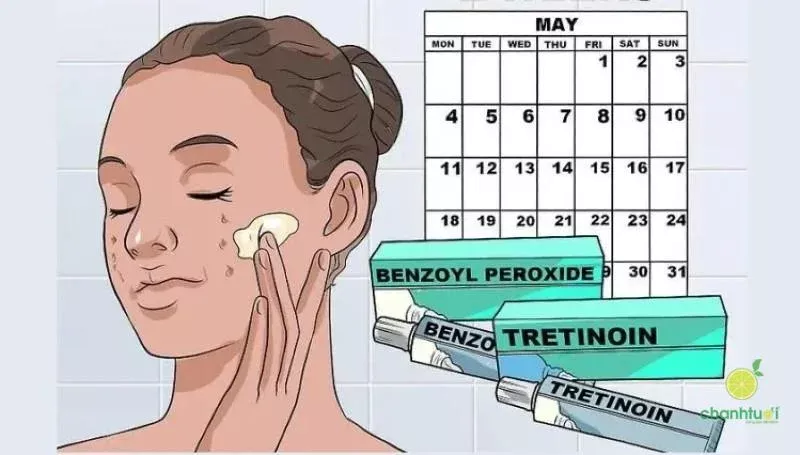 Mô tả ảnh: Hướng dẫn sử dụng Benzoyl Peroxide