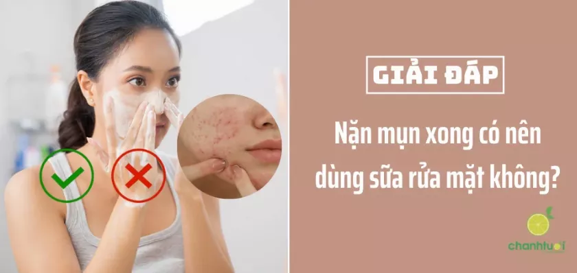 Nặn mụn xong có nên dùng sữa rửa mặt?