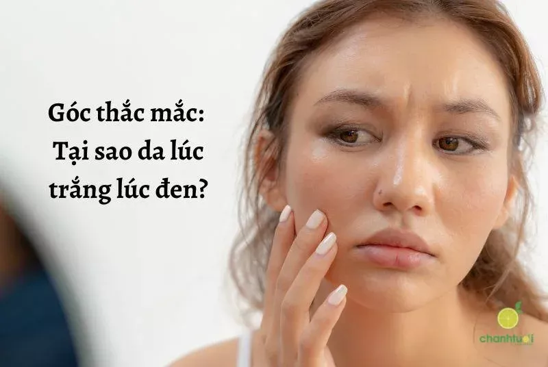 Nguyên nhân da lúc trắng lúc đen