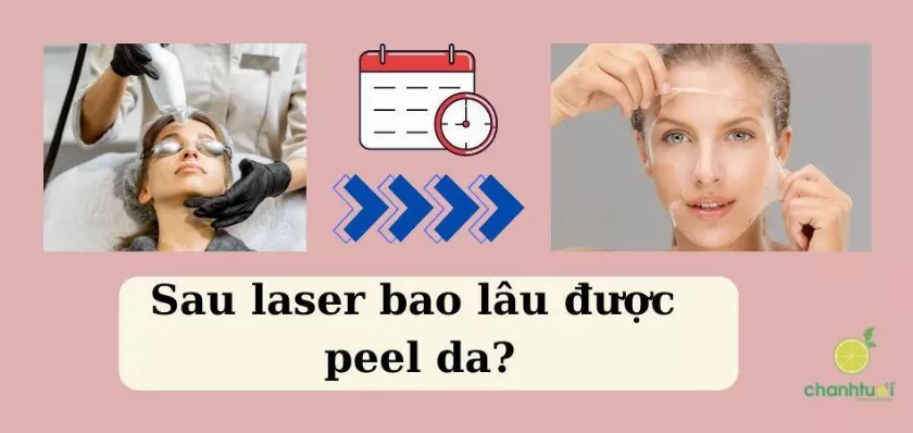 Peel da sau điều trị laser