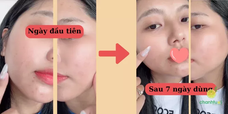 serum dưỡng trắng da 