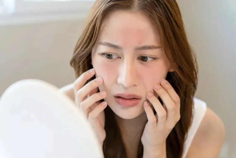 skincare cho da nhạy cảm 3