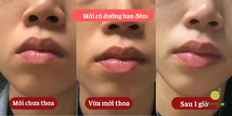 son dưỡng Mediheal màu cam 4