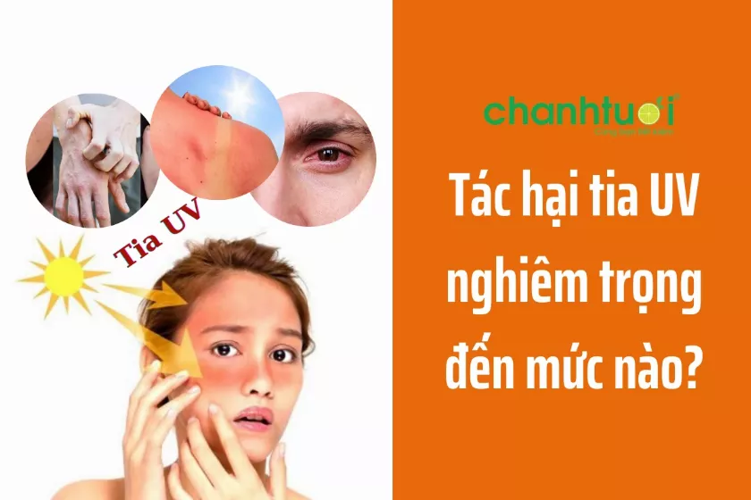 Tác hại tia UV nghiêm trọng như thế nào đối với làn da, mắt?