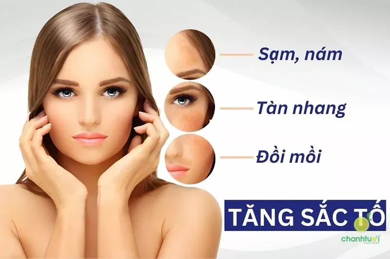 tăng sắc tố da là gì 2