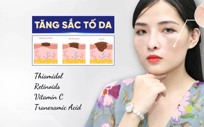 tăng sắc tố da là gì 4