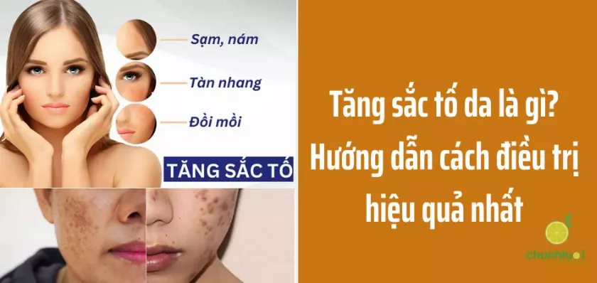 Tăng sắc tố da là gì? Nguyên nhân và cách điều trị hiệu quả nhất