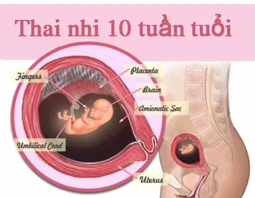 Thai nhi 10 tuần tuổi