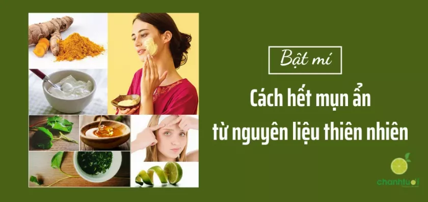 Trị mụn ẩn bằng nguyên liệu thiên nhiên