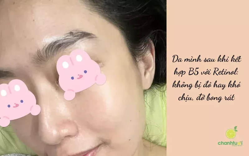 Vitamin B5 dupe Medik8 SIMPLICITY hiệu quả