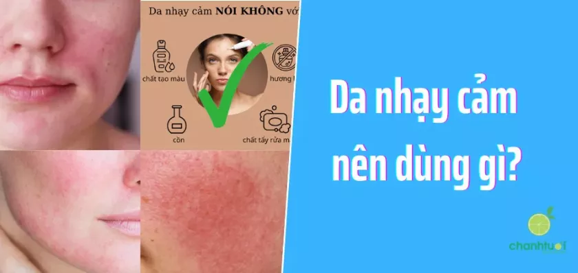 alt text: Da nhạy cảm dễ kích ứng cần được chăm sóc đặc biệt