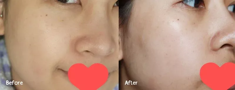 alt text: Hình ảnh so sánh da trước và sau khi dùng Sulwhasoo First Care Activating Serum, da đàn hồi và bớt khô hơn