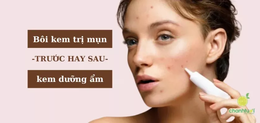 Bôi trị mụn trước hay dưỡng ẩm trước - Thứ tự chuẩn cho da