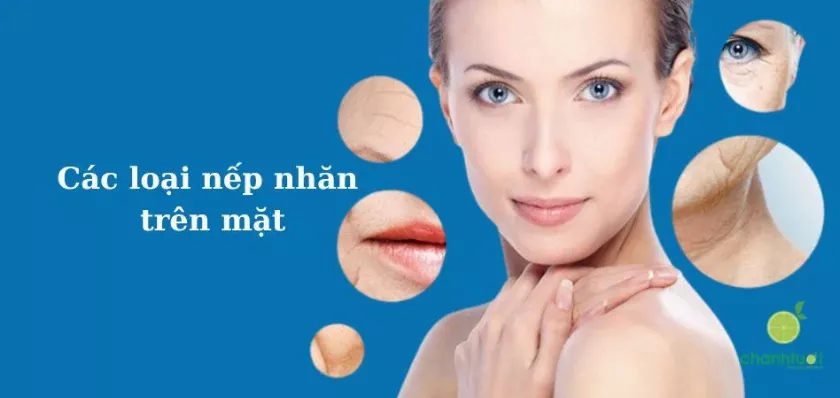 Các loại nếp nhăn trên mặt