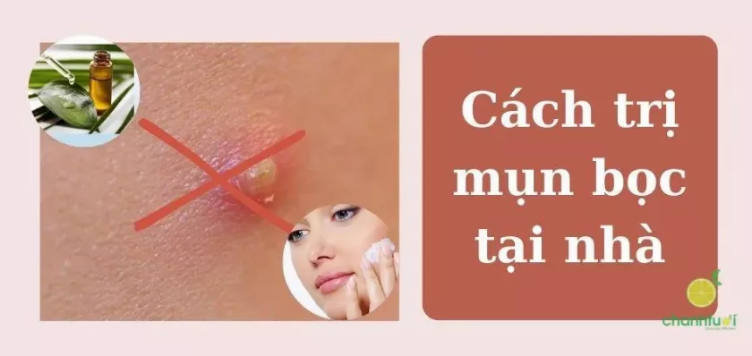 Cách trị mụn bọc tại nhà