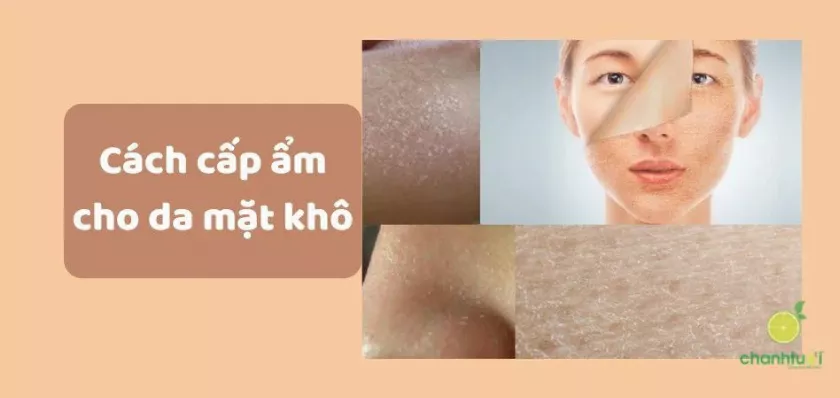 Cấp ẩm cho da mặt khô