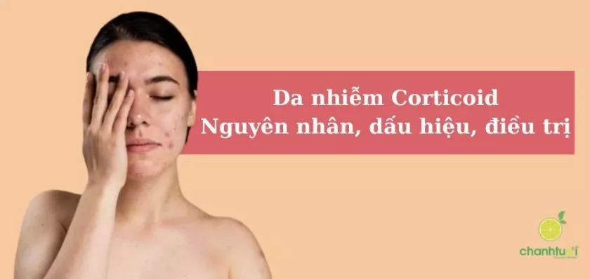 Da bị nhiễm corticoid