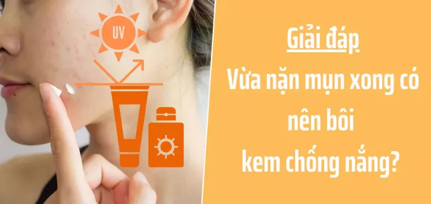 Giải đáp: Vừa nặn mụn xong có nên bôi kem chống nắng?