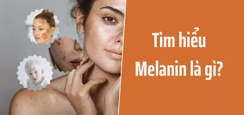 Melanin là gì? Có bao nhiêu loại? Những rối loạn liên quan đến melanin