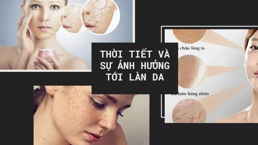 Mối liên hệ bất ngờ giữa thời tiết và làn da của bạn