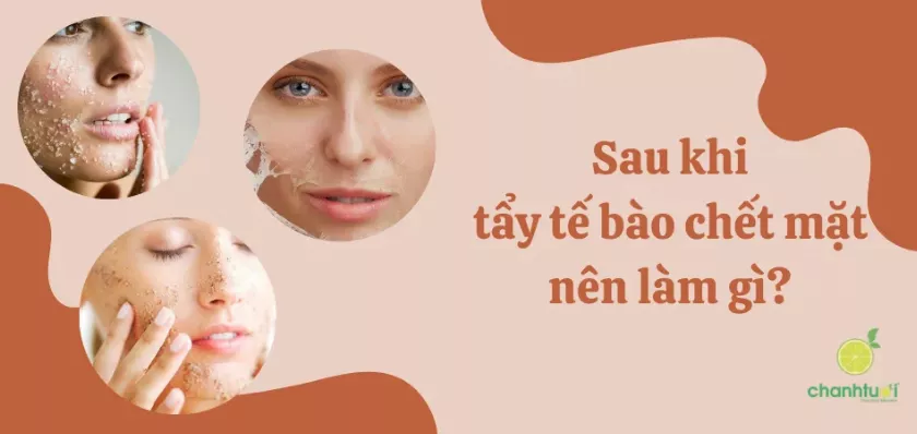 Sau khi tẩy tế bào chết mặt nên làm gì? Cần tránh gì?