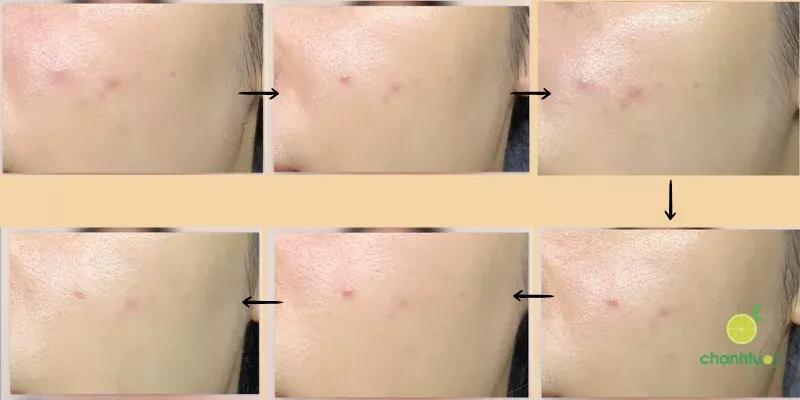 kem dưỡng melatonin hiệu quả
