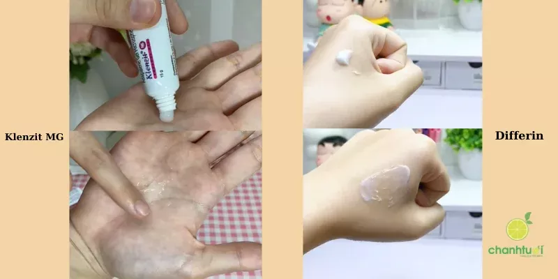 Kết cấu 2 loại