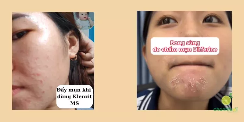 Một số hiện tượng khi dùng